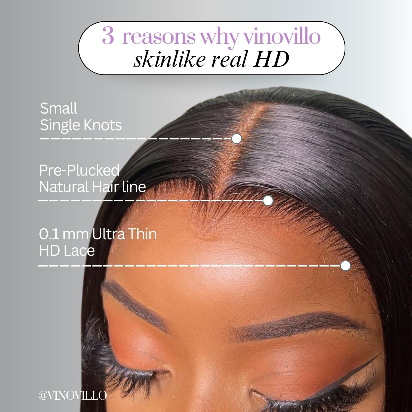 Vinovillo 5X5 Skinlike Real Hd Lace Closure Only Body Wave Ultra Thin Invisible