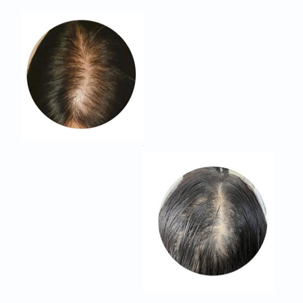 Silk Base Curly Wavy Clip In Human Hair Toppers -Loss Thin Hair Top Replacement