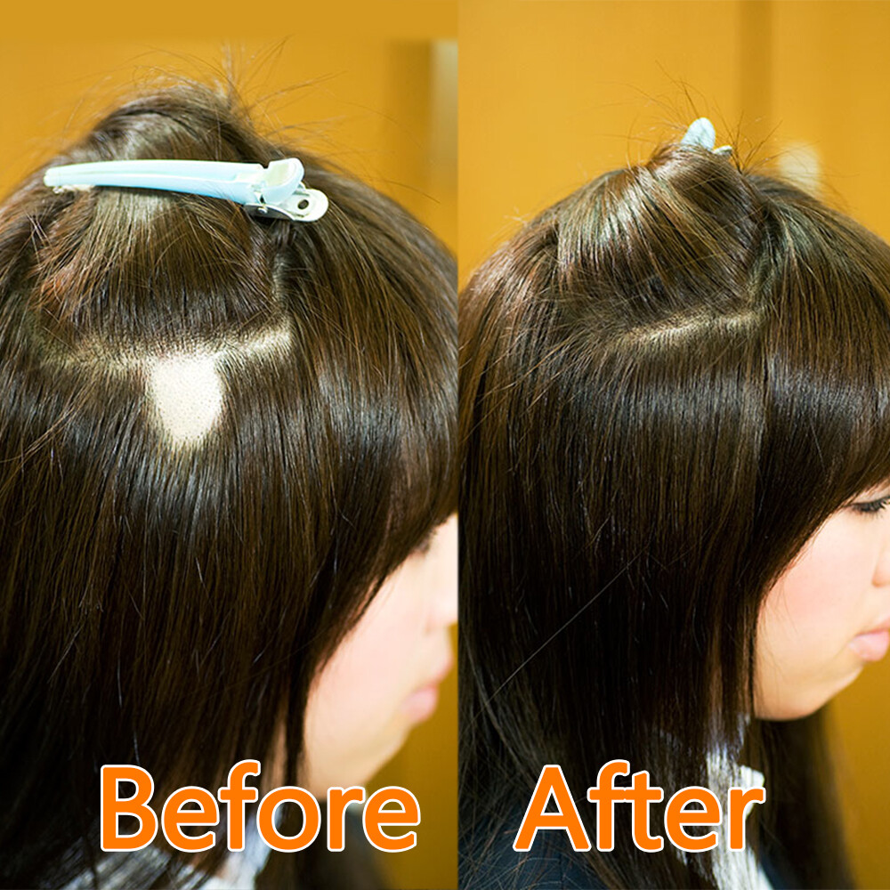 Full Lace Cover-up Tape Human Hair Patches Hairpiece for Alopecia Areata 8″ 18″