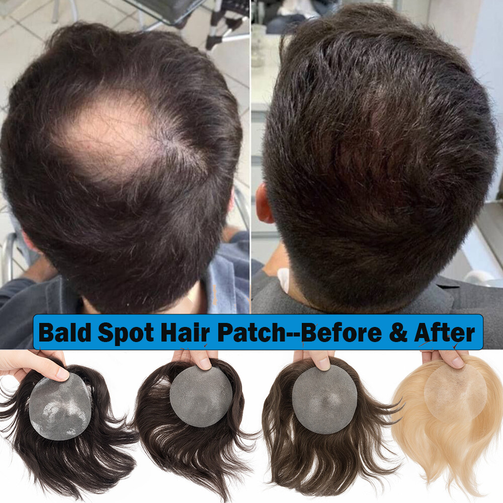 Full PU Bald Spot Remy Human Hair Cover-up Hair Patches Head Top Replacement 8*8