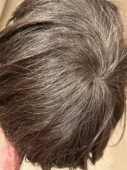 Lavivid men’s hair system – new never worn – lace with poly perimeter – Ash4