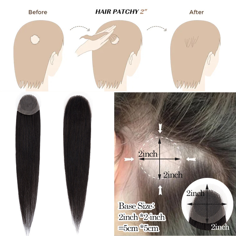 Thin Skin Bald Spot Hair Patch Natural Human Hair Replacement Unit For Hairline