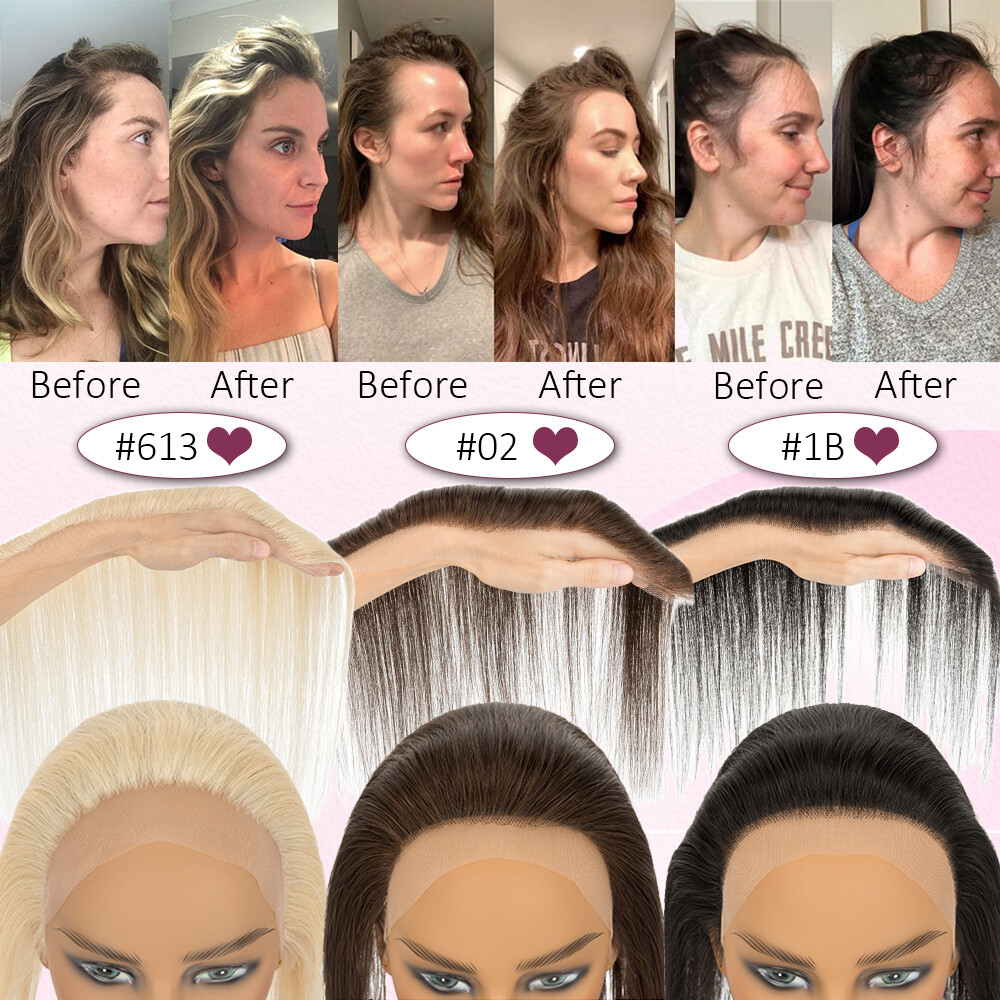 Receding Hairline Full Lace Cover Up 100% Remy Human Hair Patches Pieces Topper