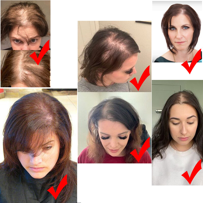 Natural Clip In Human Hair Topper Hairpiece Toupee Wigs Bangs For Thinning Hair