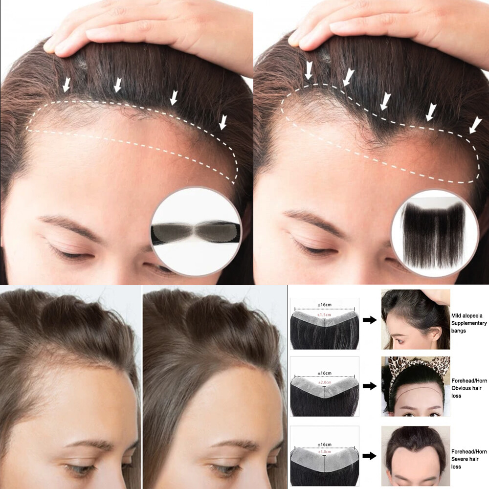 Full Lace Cover-up Front Hairline Hairpiece Remy Human Hair Patch Topper Toupee