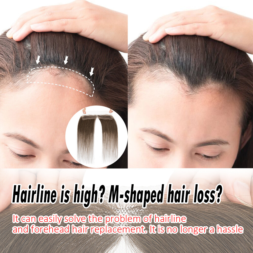 Receding Hairline Full Lace Cover Up 100% Remy Human Hair Patches Pieces Topper