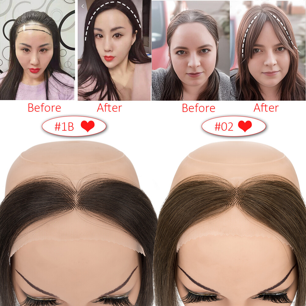 Receding Hairline Full Lace Cover Up 100% Remy Human Hair Patches Pieces Topper