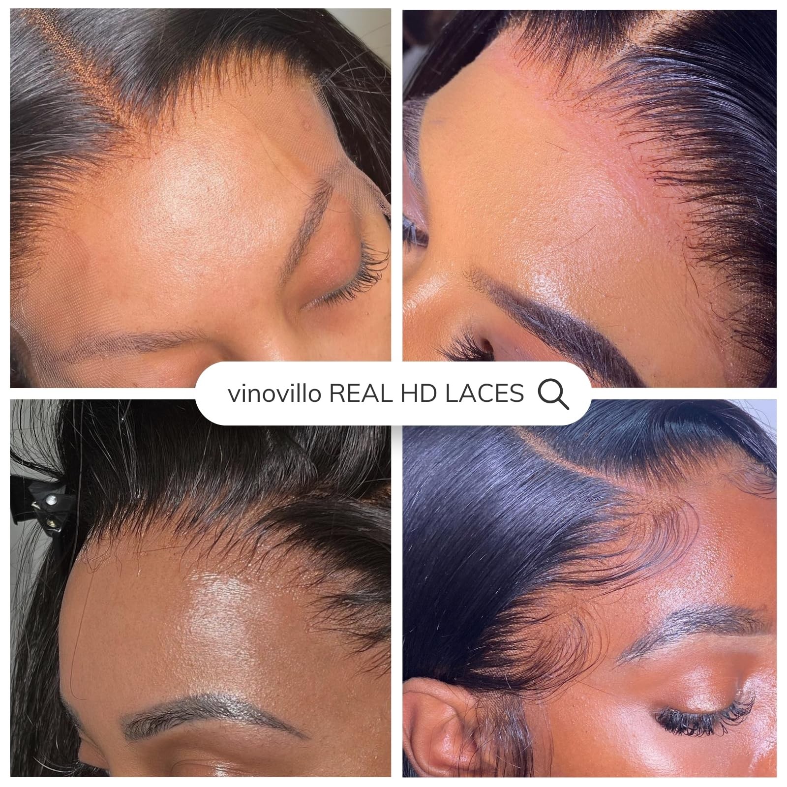 Vinovillo 2X6 Skinlike Real Hd Lace Closure Only Body Wave Ultra Thin Invisible