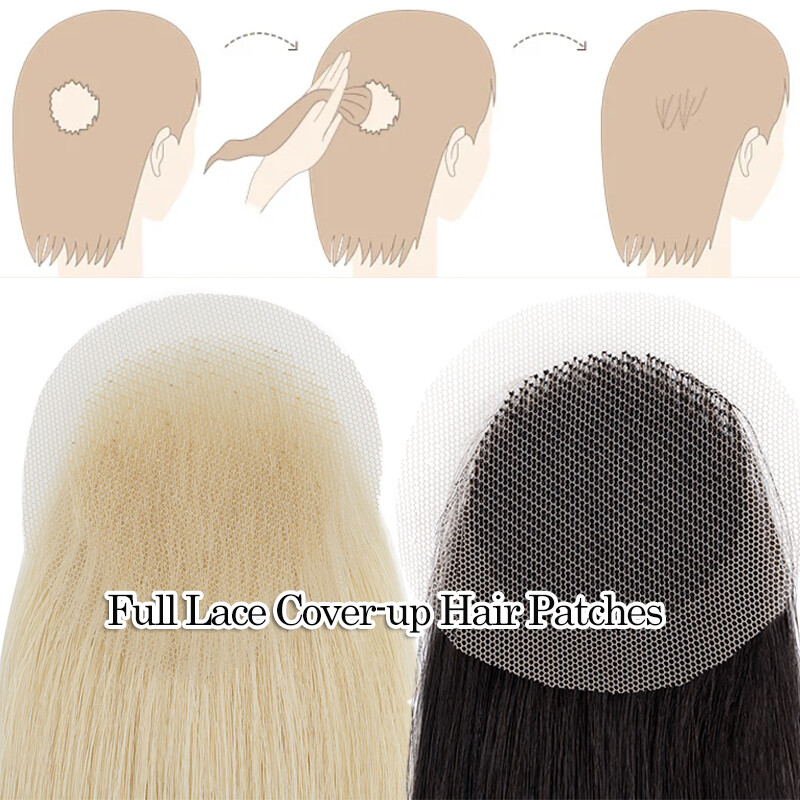 Thin Skin Bald Spot Hair Patch Natural Human Hair Replacement Unit For Hairline