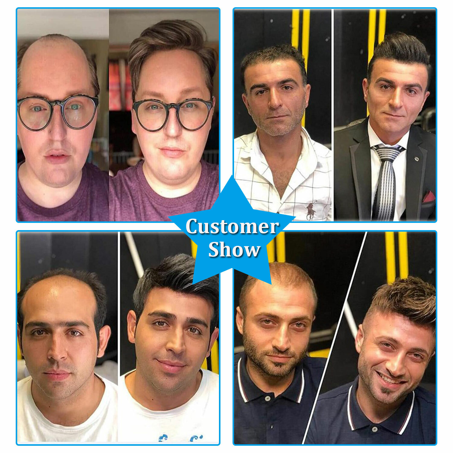 Men 100% Human Hair Replacement System Hairpiece Skin PU Base Toupee Black/Brown