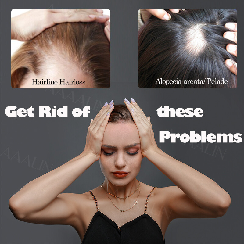 Thin Skin Bald Spot Hair Patch Natural Human Hair Replacement Unit For Hairline