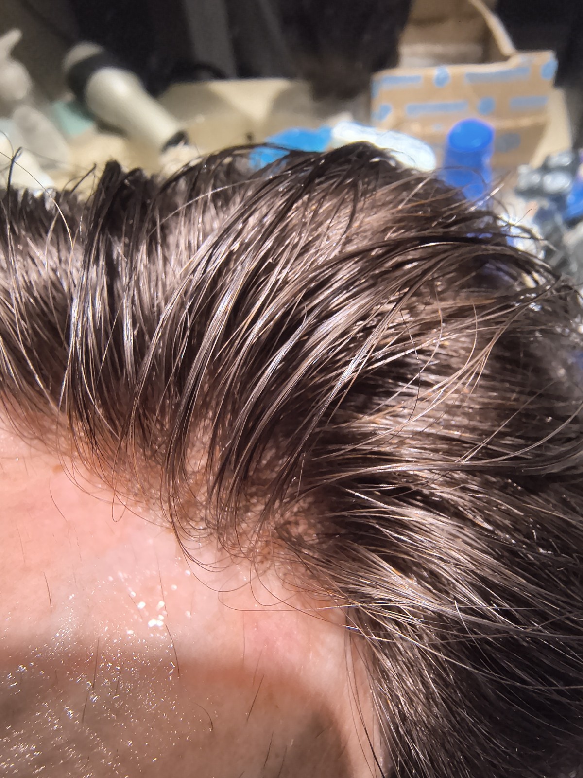 Toupee For Mens German Lace Human Hair Replecement System. Color #4 8×10