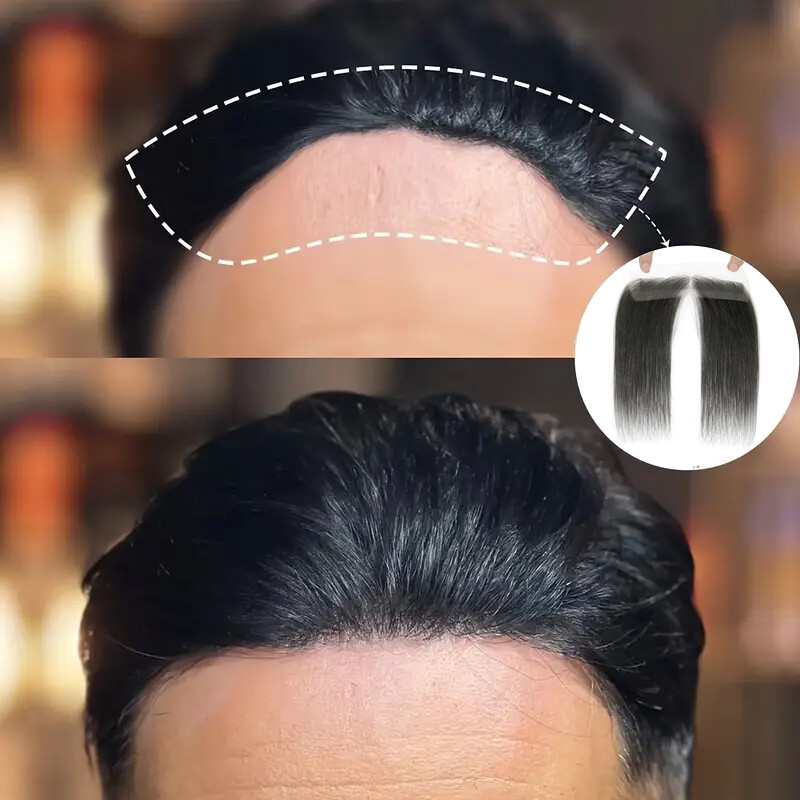 Women Topper REMY 100 Human Hair Toupee Forehead Hairline Lace Base Skin Thin 8A