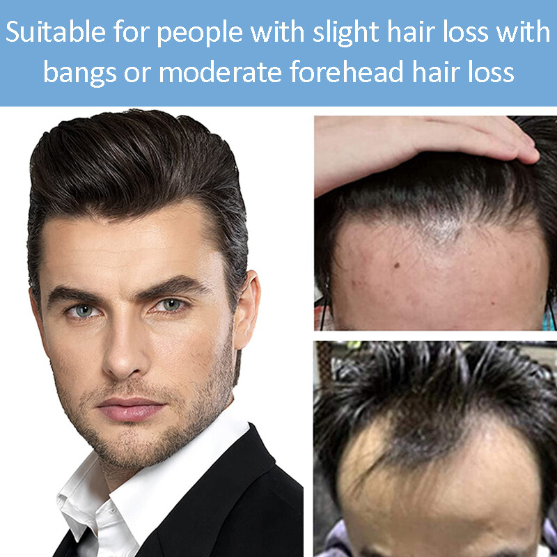 Men Forehead Hairline Toupee 100%Human Hair Skin PU Man Hairpiece Frontal Topper