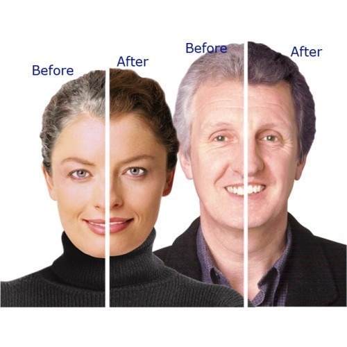 Grey Hair Reversal – NATURAL ANTI GRAY HAIR COMPLEX 1350mg – 1 Bottle 60 Capsule