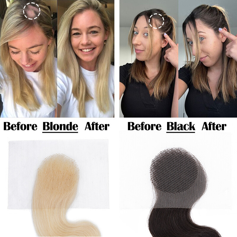 Human Hair Patch Full Lace Cover-up Topper Hairpiece for Women’s Alopecia Areata