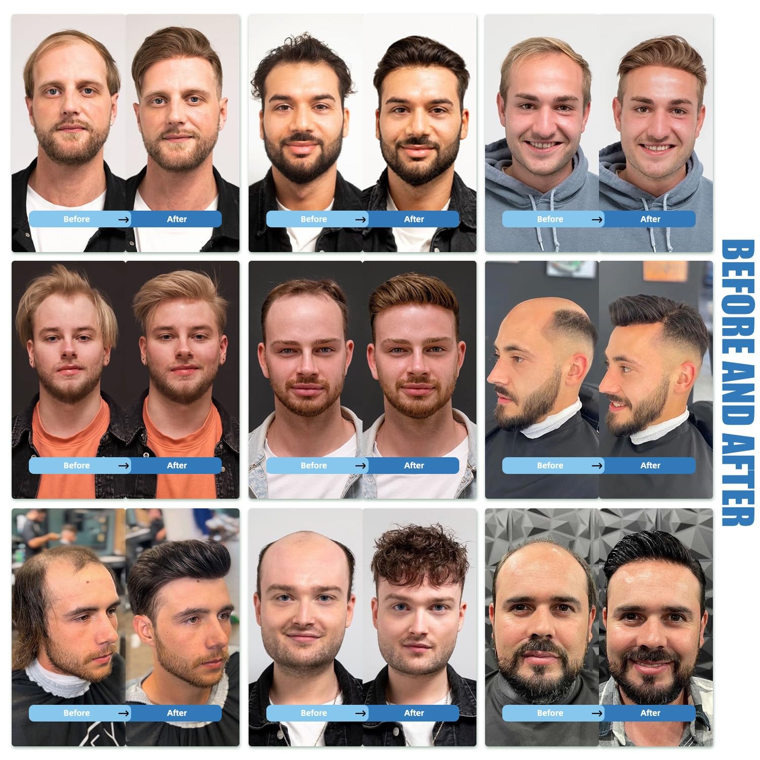 Prosa Toupee For Men Human Hair Replacement System Mens Toupee Real Human 3 8X10