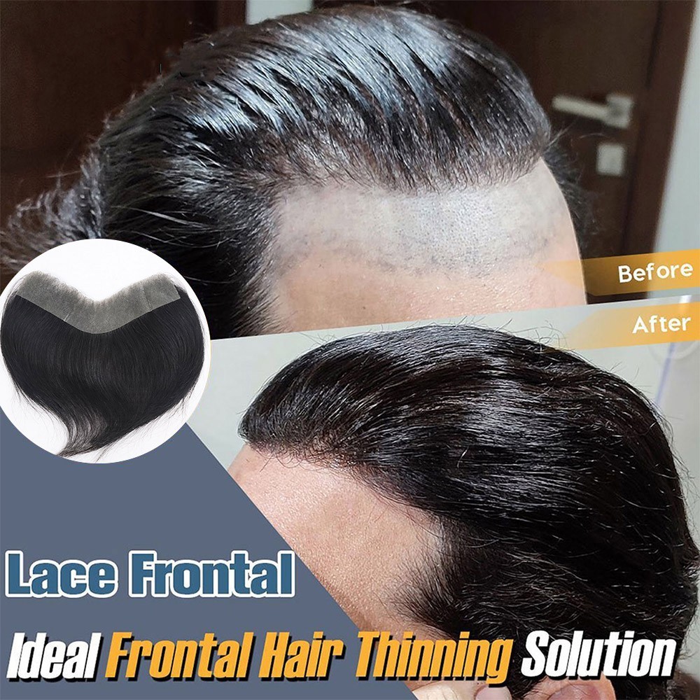 Mens Toupee Human Hair Forehead Hairline Skin PU Hairpiece Replacement System