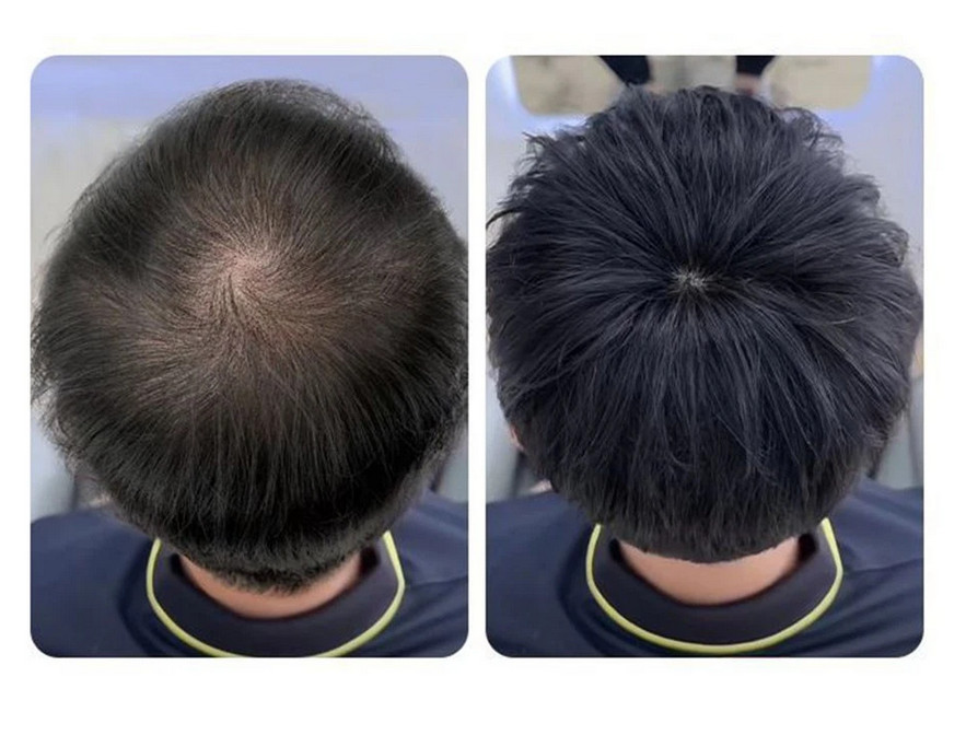 100% Real Human Hair Clip in Short Thin Hair For Men Hair Bangs Replacement