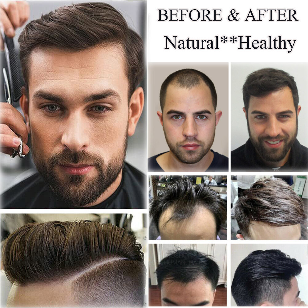 Natural Forehead Hairline Thin Skin PU Toupee Topper Men Human Hair Hairpiece 9A
