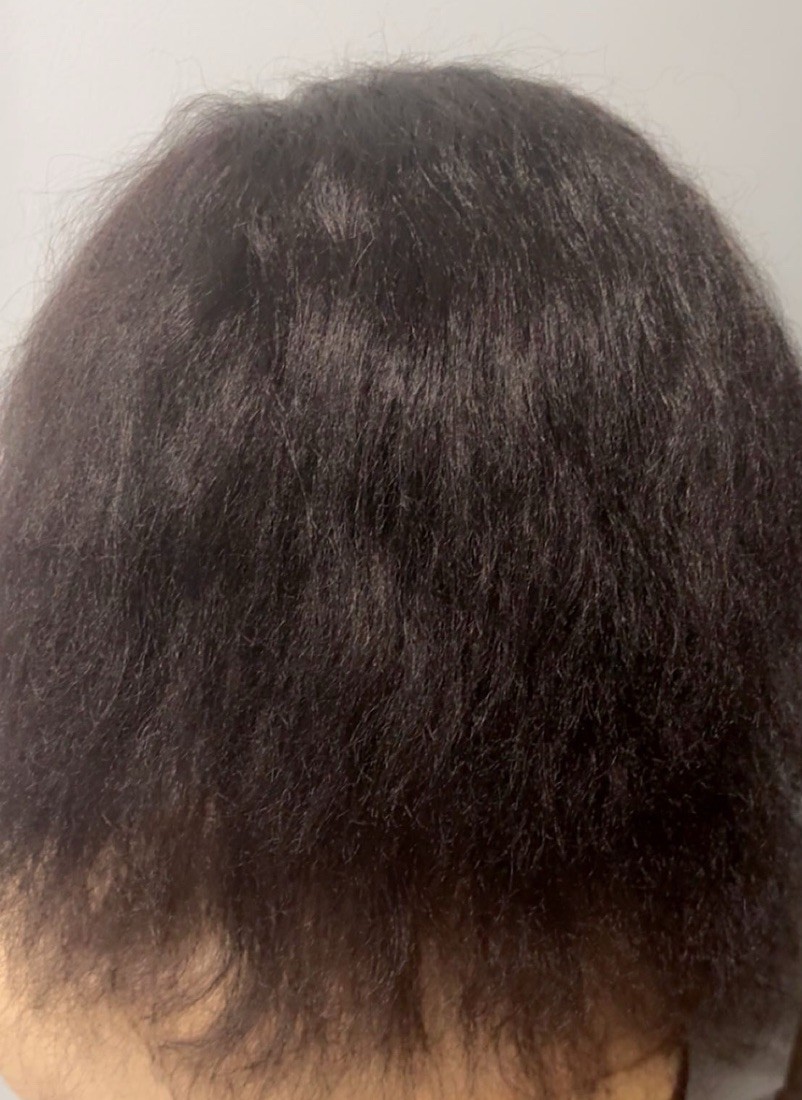 1pcs Full Lace Ventilated Cap With 14″Long Hair For Braided Wig Medium Size