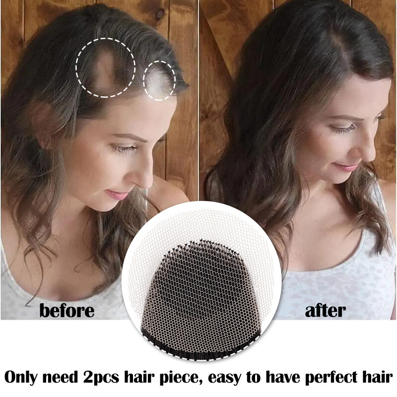 Human Hair Patch Full Lace Cover-up Topper Hairpiece for Women’s Alopecia Areata