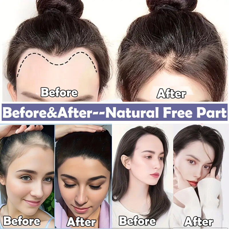 Women Topper REMY 100 Human Hair Toupee Forehead Hairline Lace Base Skin Thin 8A