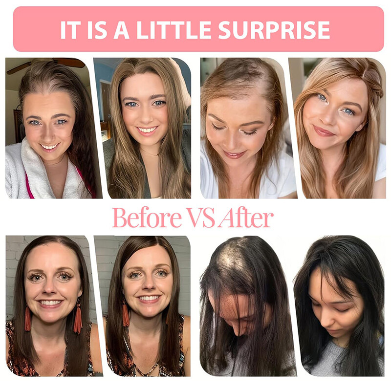 Free Part Women Topper Real As Human Hair Top Toupee Piece Clip in Hairpiece 18″