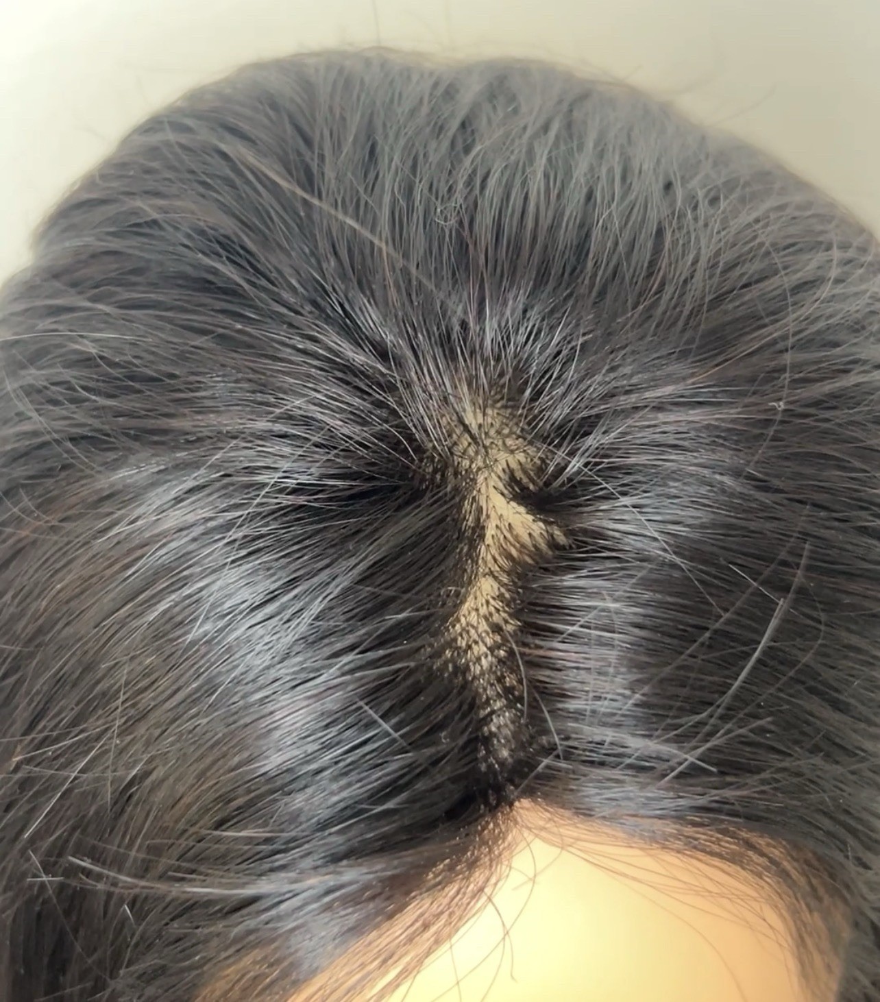 8×10 22” Indian Human Hair Topper | Hair System | Clipless | 170g