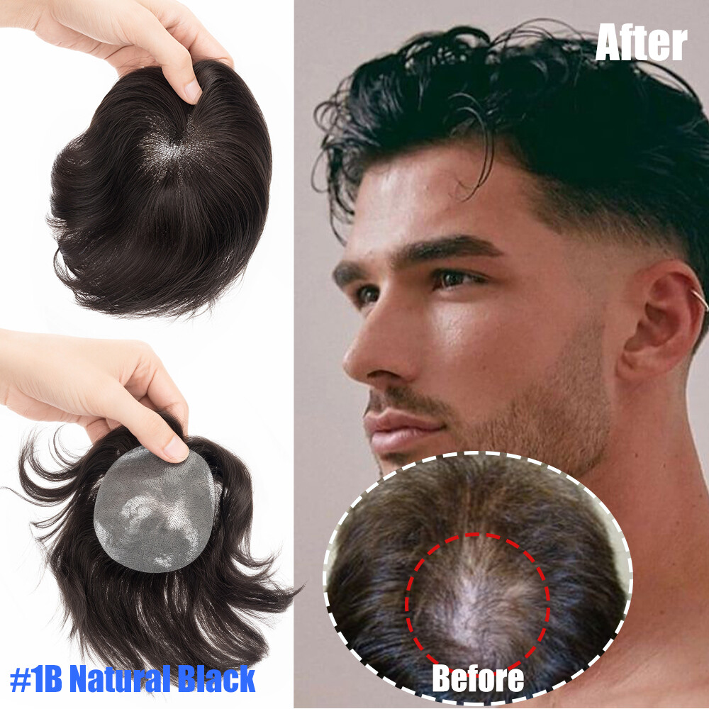 Men Frontal Hairline Temple Hair Patch Remy Human Hair Cover up Topper Bald Spot