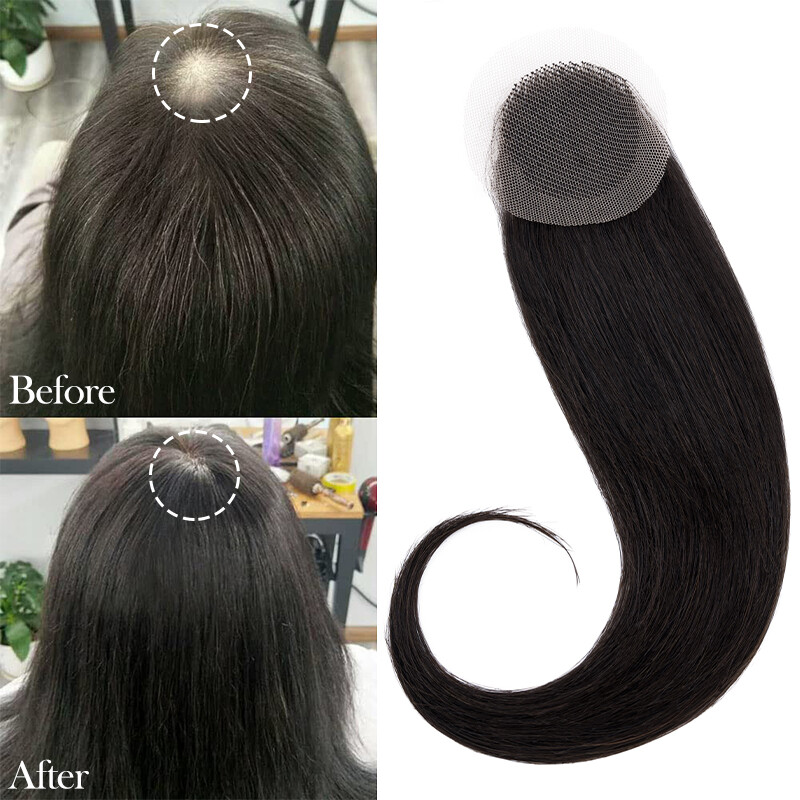 Human Hair Patch Full Lace Cover-up Topper Hairpiece for Women’s Alopecia Areata