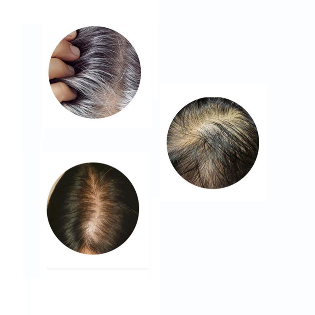 Silk Base Curly Wavy Clip In Human Hair Toppers -Loss Thin Hair Top Replacement