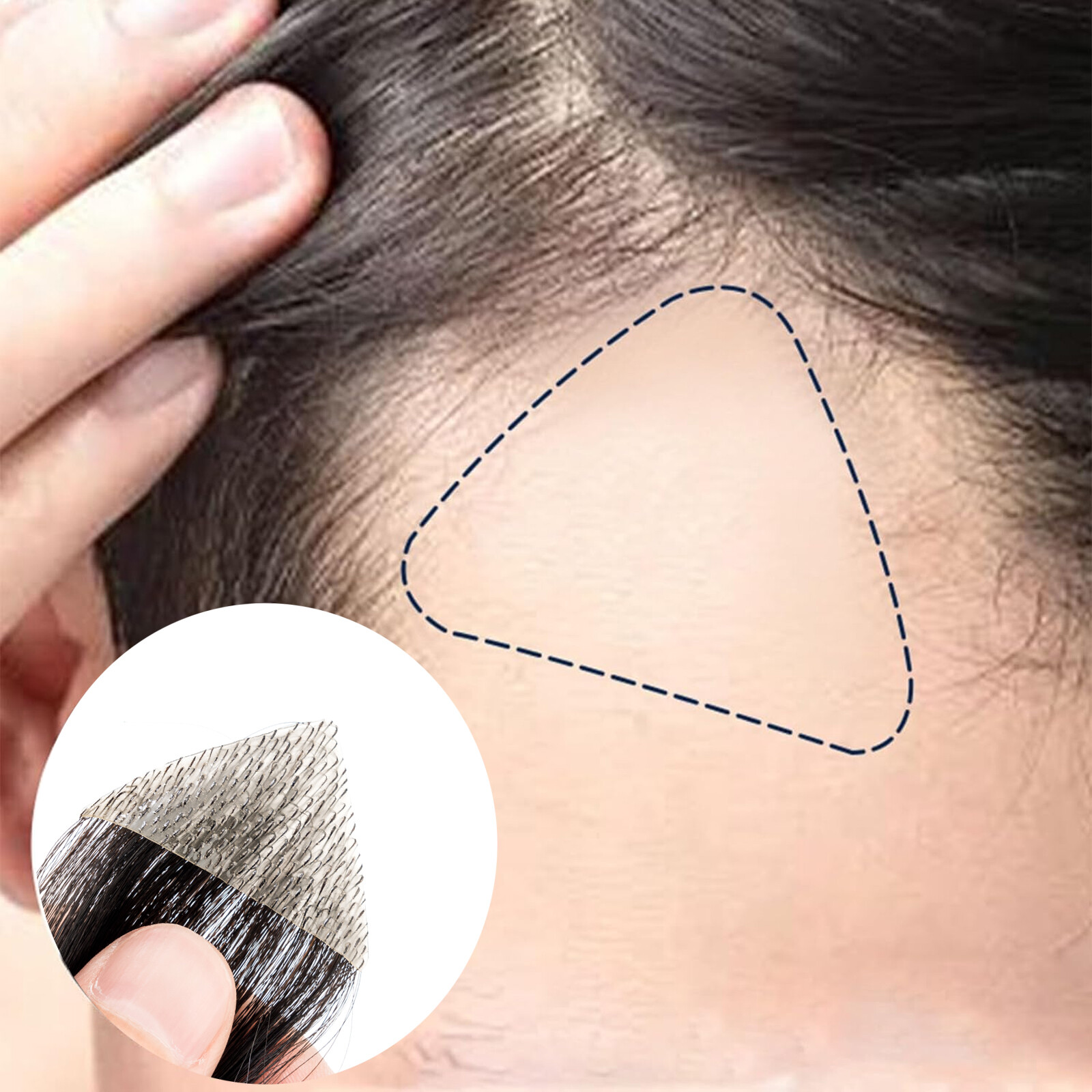 Full PU Bald Spot Remy Human Hair Cover-up Hair Patches Head Top Replacement 8*8