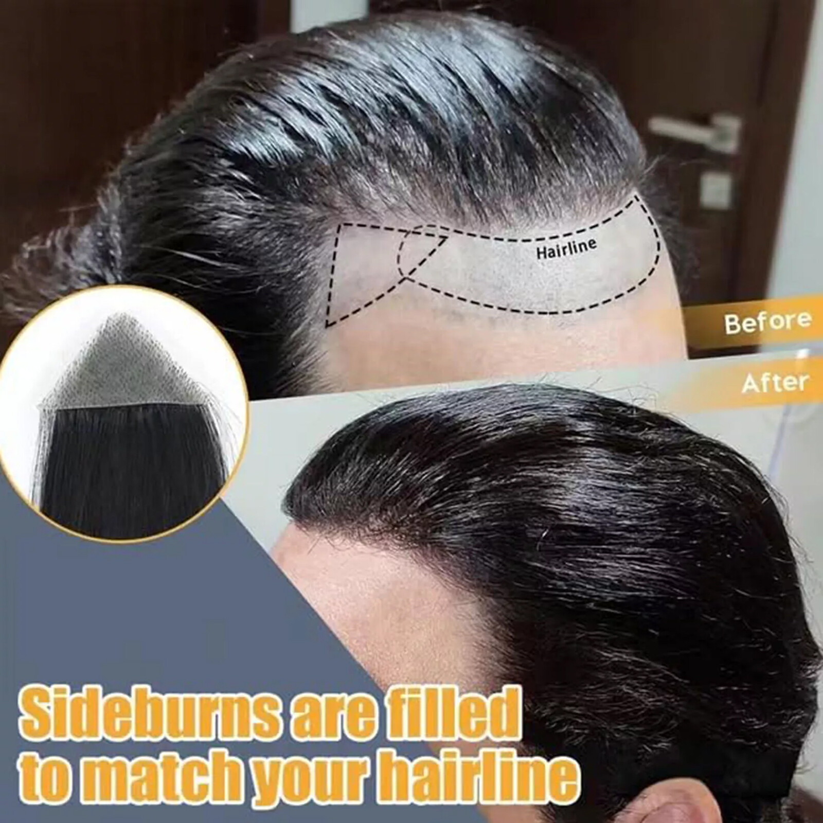 Full PU Bald Spot Remy Human Hair Cover-up Hair Patches Head Top Replacement 8*8