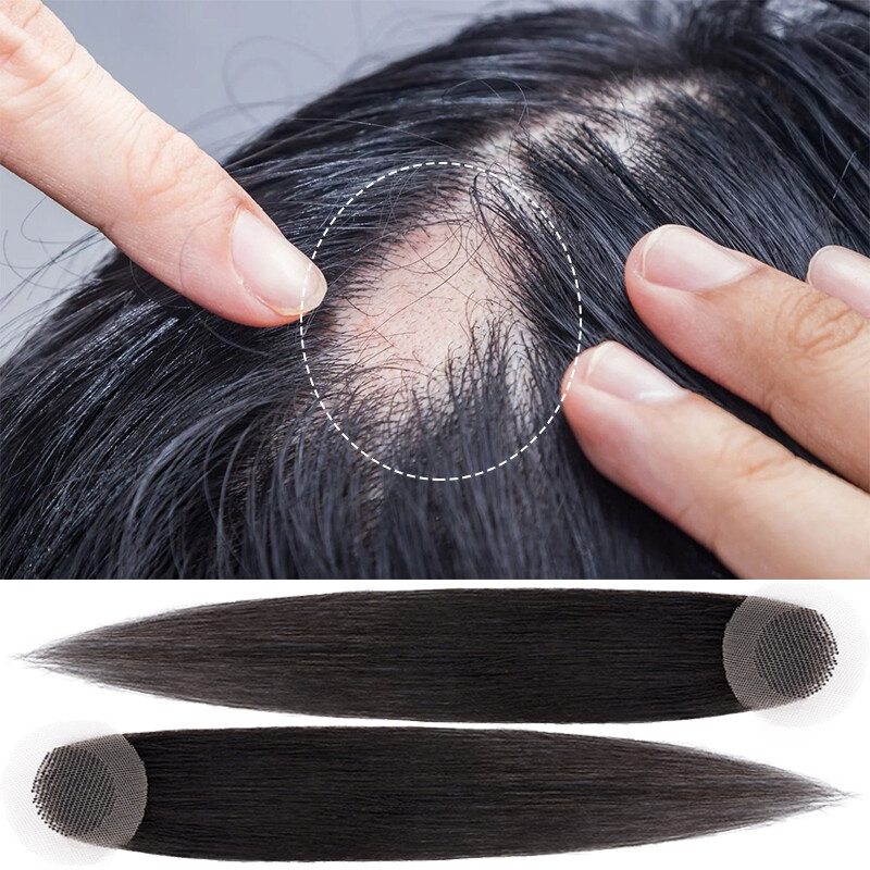 Bald Spot Cover-up Hairpiece Patch Topper Silk Base Remy Human Hair Non-Surgical